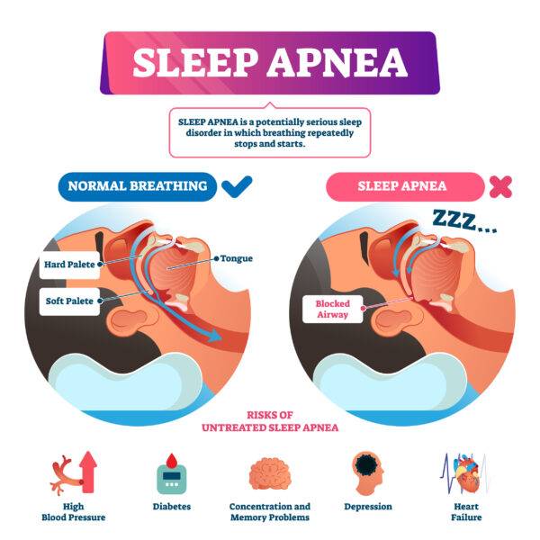 Can Sleep Apnea Cause Me To Be Tired All The Time