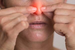 Do All Nasal Polyps Need to be Removed? featured image