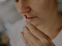 Why do I keep getting nosebleeds? featured image