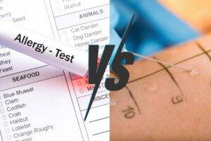 What’s the Difference Between a Blood and Skin Prick Allergy Test featured image